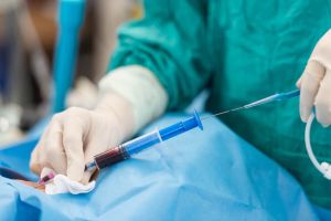 Een gezondheidswerker met steriele handschoenen brengt een naald aan in een ader van een patiënt en neemt bloed op in een spuit tijdens een medische procedure, terwijl operatiedoeken zichtbaar zijn.
